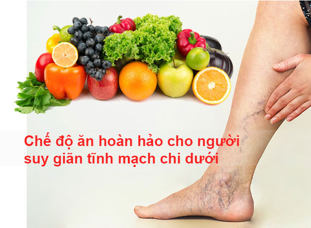 Chế độ ăn hoàn hảo cho người suy giãn tĩnh mạch chi dưới 